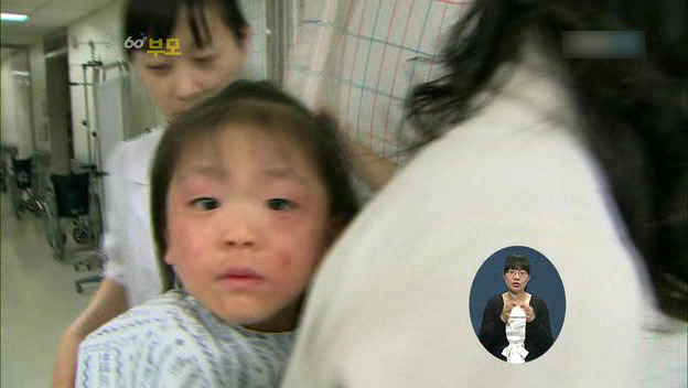 [60분부모] 아토피가 아이의 자존감을 낮춘다 ① | 인스티즈