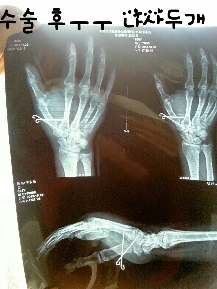 중국 수술 수준 (혐오주의) | 인스티즈