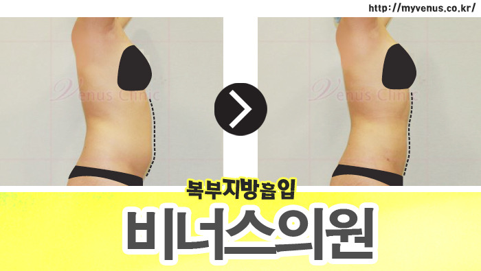 비너스의원 이미지