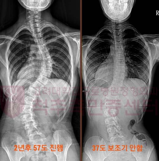 현대인이 많이 앓고 있는 질병중의 하나 | 인스티즈