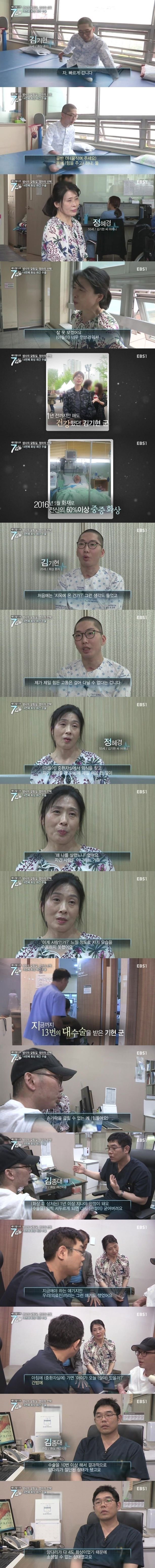 화상 환자들이 겪는 고통.jpg | 인스티즈