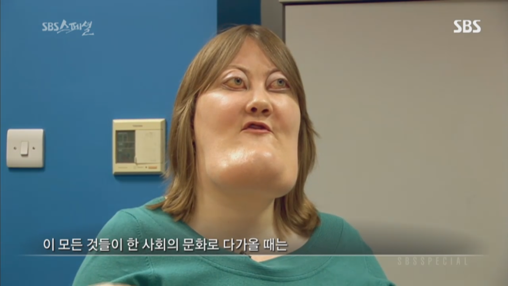 기형적 턱을 가진 여자 비키 라이트가 성형수술을 하지 않는 이유 | 인스티즈