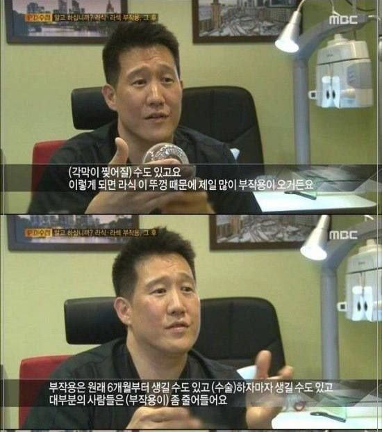 라식 라섹수술을 하면 안되는 이유....jpg | 인스티즈
