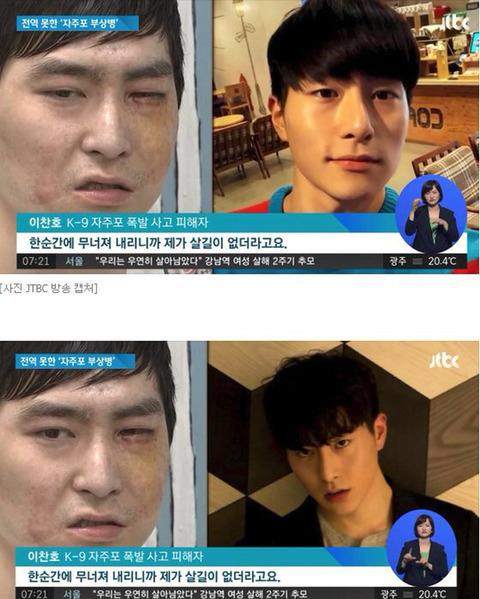안녕하세요 저는 자주포사고 부상자 이찬호입니다. (사진 꼭 주의하고 들어와) | 인스티즈