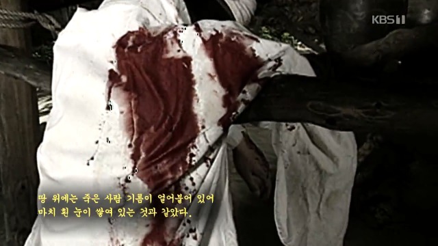 [역사저널그날] 일본 대학교에 방치되어 있던 조선인의 유골 | 인스티즈