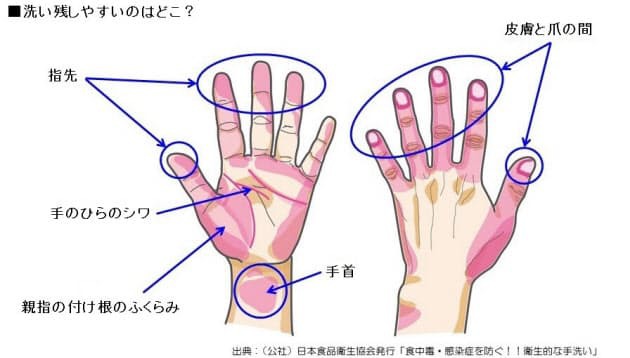 빛난다그손 이미지